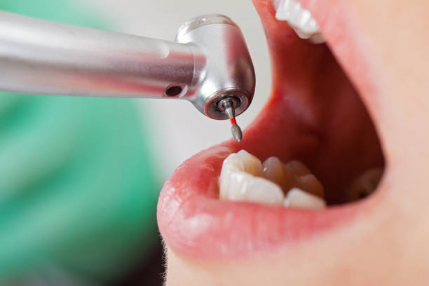 Best Chipped Tooth Repair Near Me  in Enlow, PA